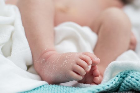 Łuszcząca się skóra u noworodka. Jak pielęgnować?